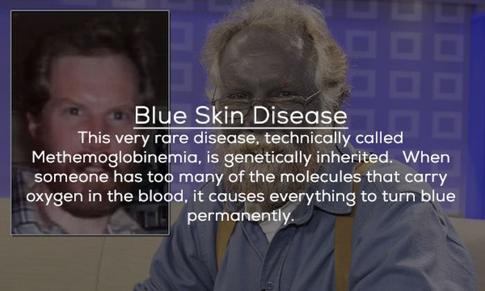 These Insane Diseases Have Baffled Scientists for Years