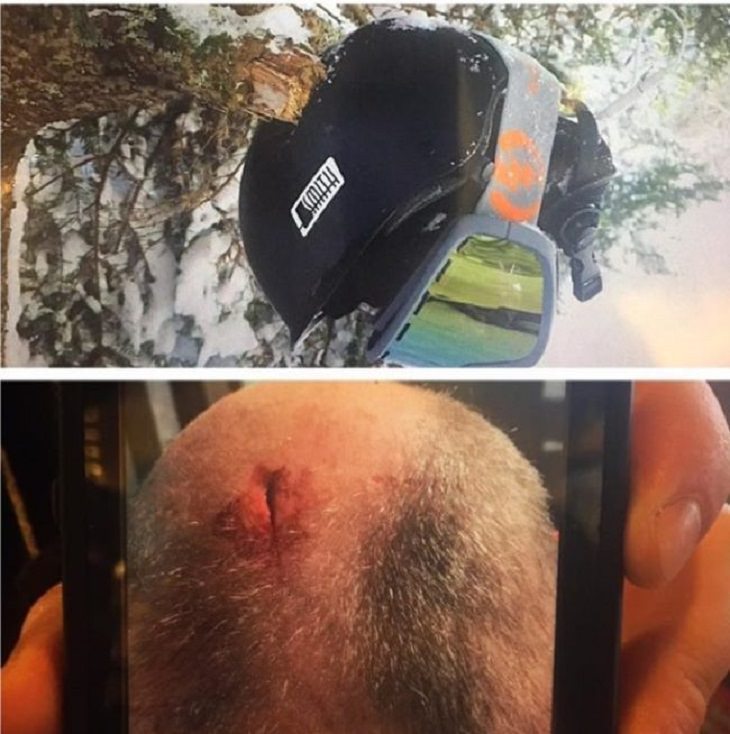 Proof That Helmets Save Lives