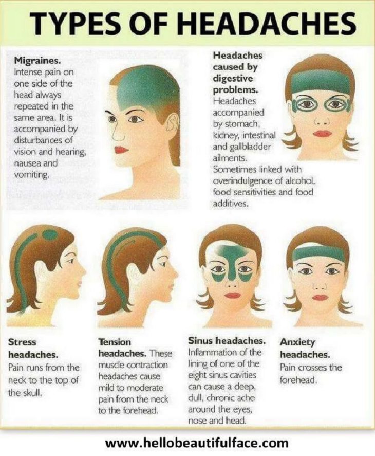 Different Headaches Chart