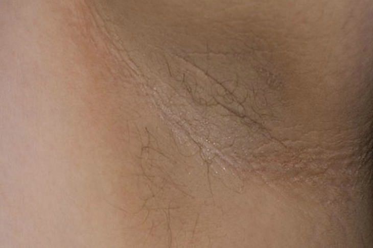7 Types of Rashes You Must Be Able to Identify