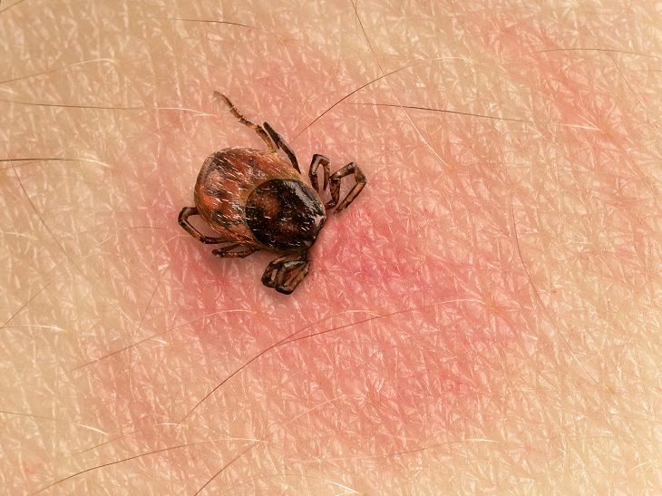 Lyme Disease: Symptoms, Treatments, and Prevention!