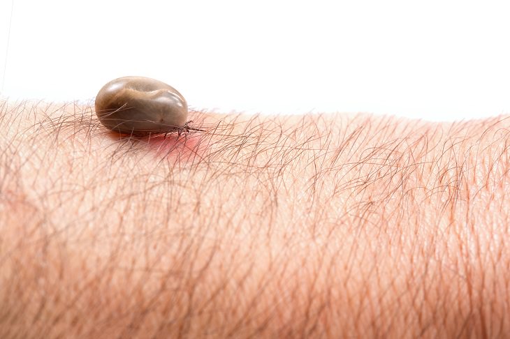 Lyme Disease: Symptoms, Treatments, and Prevention!