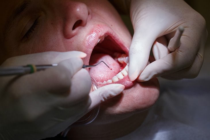 Do Your Gums Bleed? This is What Might be Causing It!
