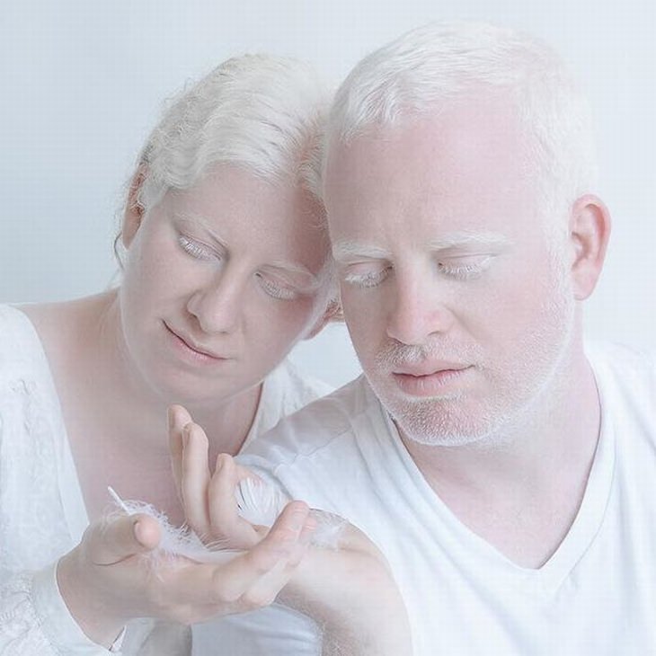 Stunning Portraits Showing Albinism S Beauty