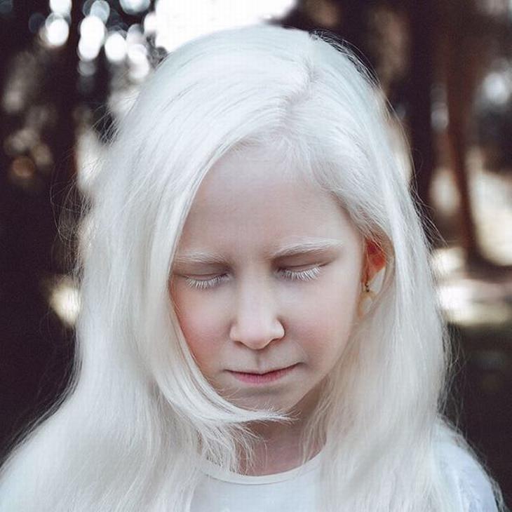 albino-portraits