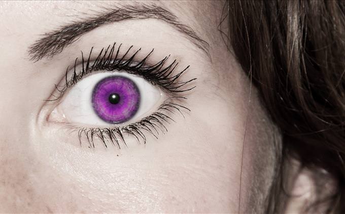 woman with purple eye