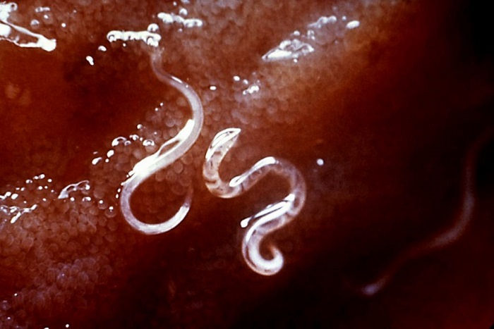 The Enemy Within: 8 Common Human Parasites