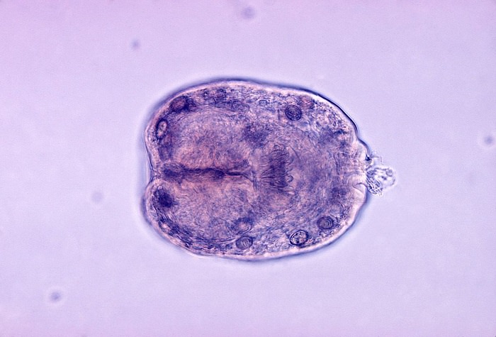 The Enemy Within: 8 Common Human Parasites