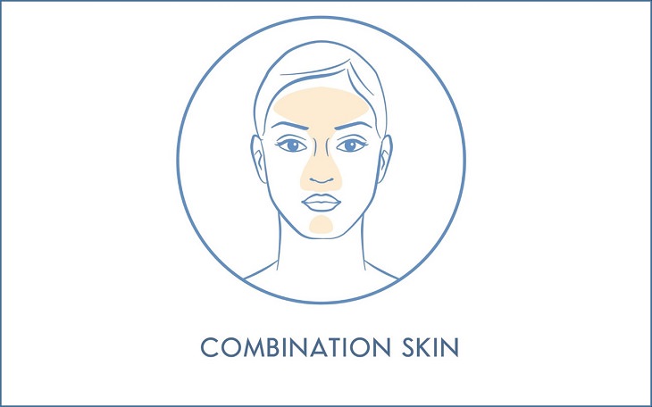 combination skin