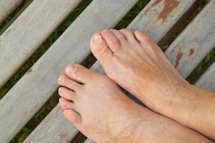 Aging Feet