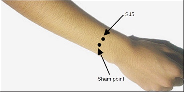 Acupressure for toothache: SJ 5 pressure points