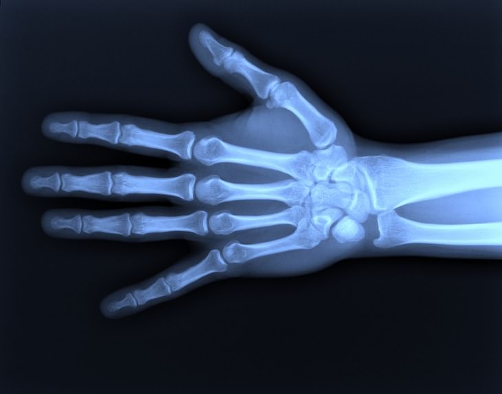 Body Parts: x ray of arm and hand
