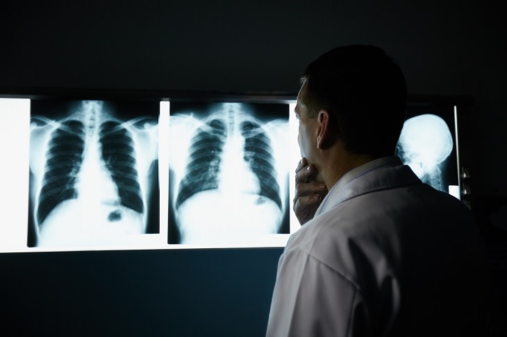 COPD - Symptoms & Diagnosis