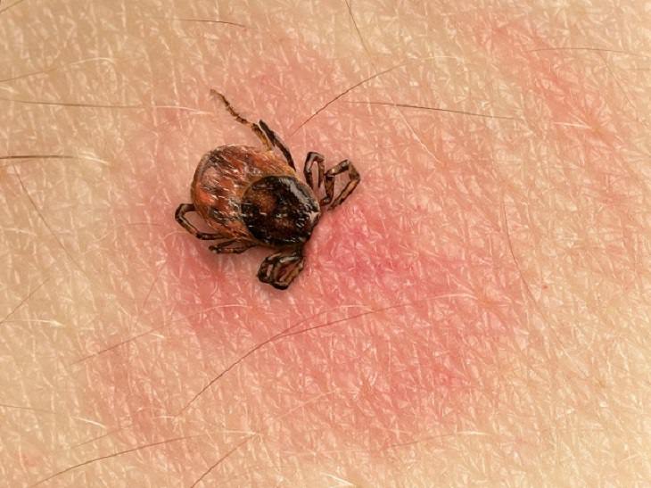 Diseases Caused by Ticks 