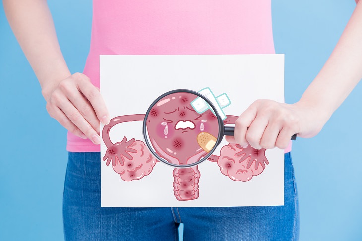 Ovarian Cancer Myths 