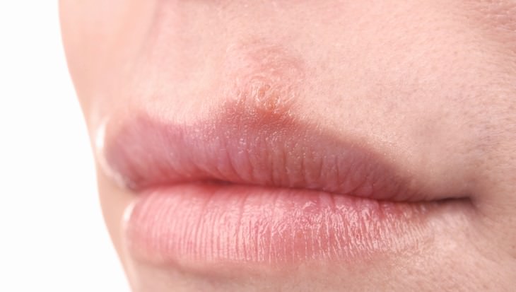 mouthwash dangers woman with dry lips