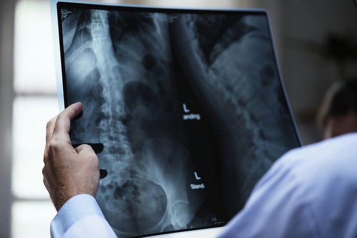 15 questions to ask doctor during exam doctor looking at Xray of the spine