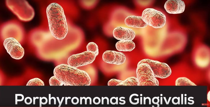 Alzheimer’s and Gingivitis study Porphyromonas gingivalis bacteria