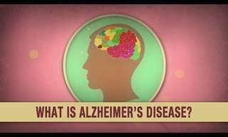 Alzheimer's Guides