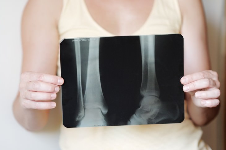 10 Greatest Medical Discoveries of the Year 2019 woman holding xray of legs