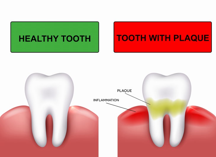 cow's milk health facts teeth