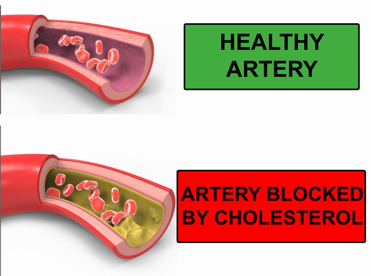 cow's milk health facts heart disease