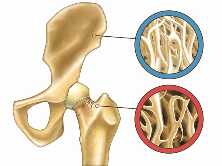 cow's milk health facts osteoporosis