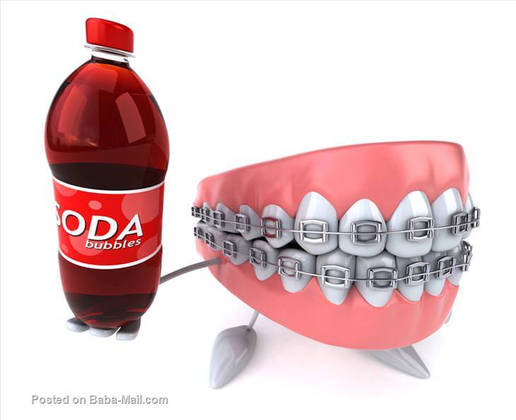 The dangers of diet soda: teeth