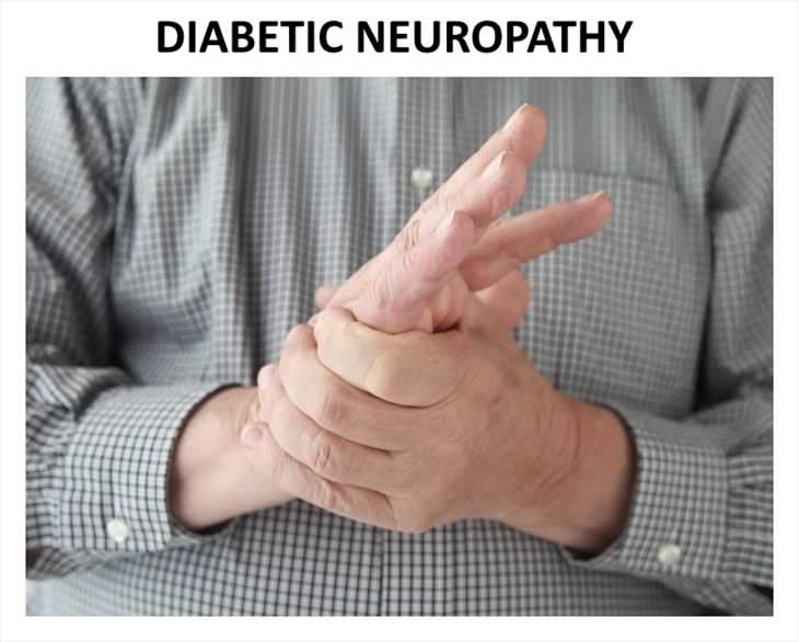 Causes Of Hand Numbness Diabetic Neuropathy