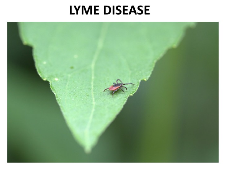 Causes Of Hand Numbness Lyme disease