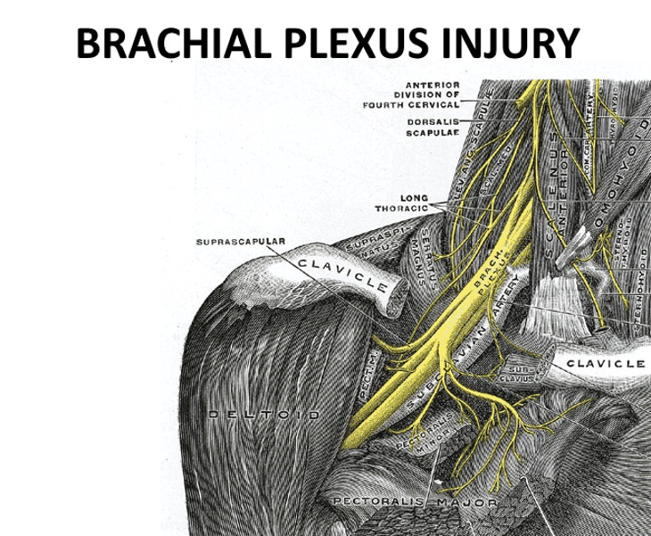 Causes Of Hand Numbness Brachial Plexus Injury