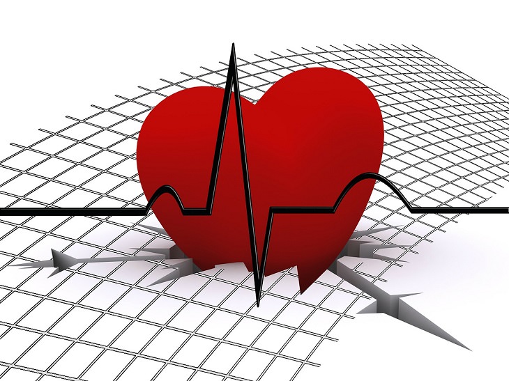 Women's health: heart attack