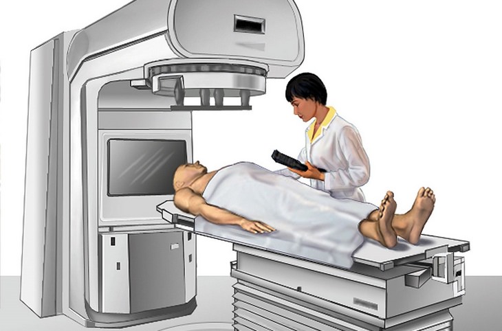 Anosmia: radiation