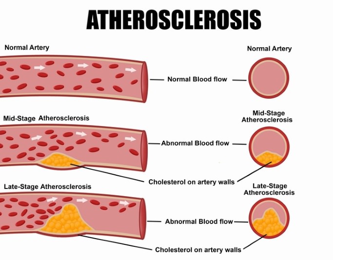 soy guide cholesterol