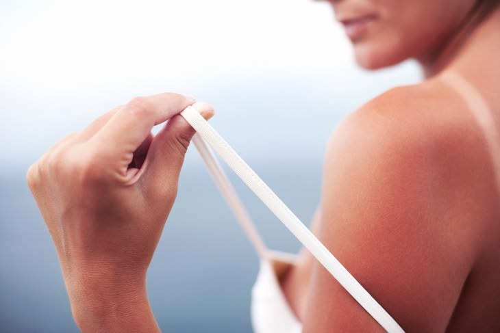 heat affects medications sunburn