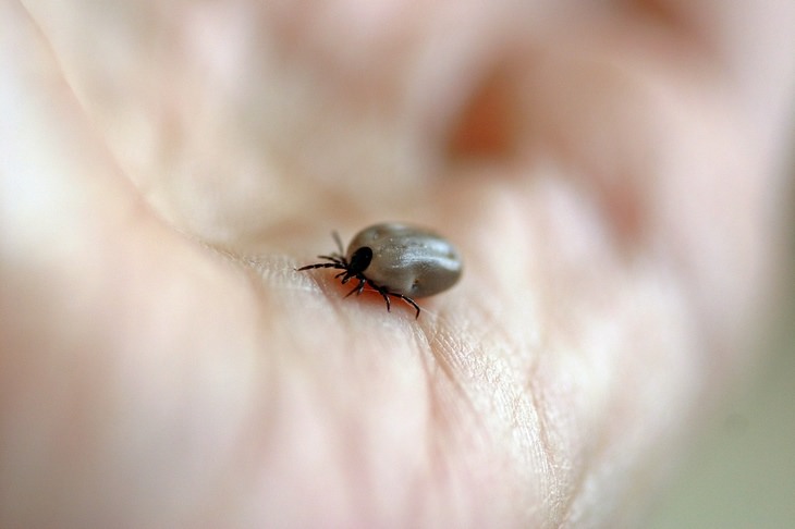 Lyme disease: tick in palm