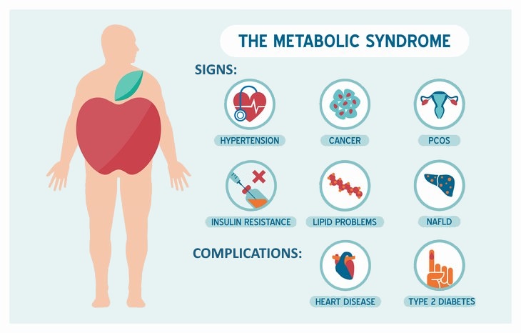 metabolic syndrome Signs and Symptoms