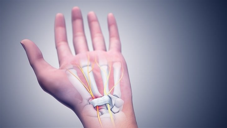 Tuina massage guide carpal tunnel syndrome