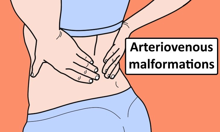 tingling in the back causes Arteriovenous malformations