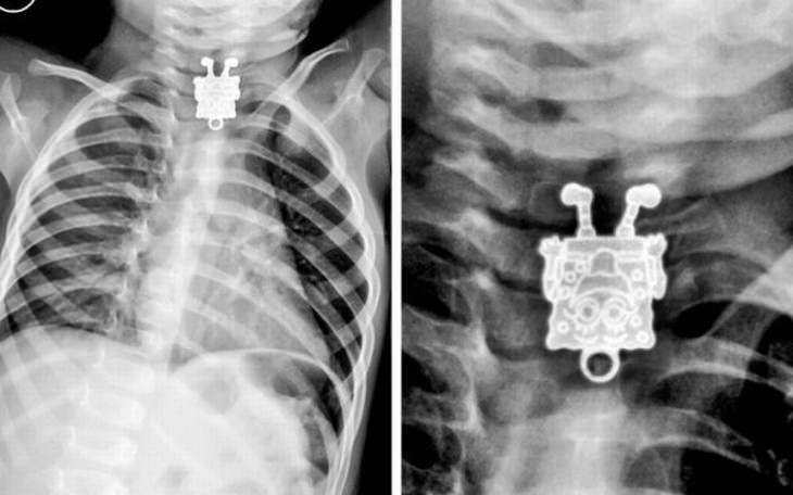 X-Ray Images Spongebob
