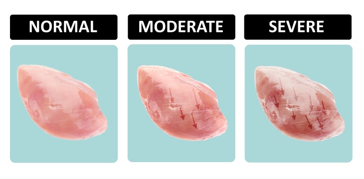 chicken breast nutrition striping variations