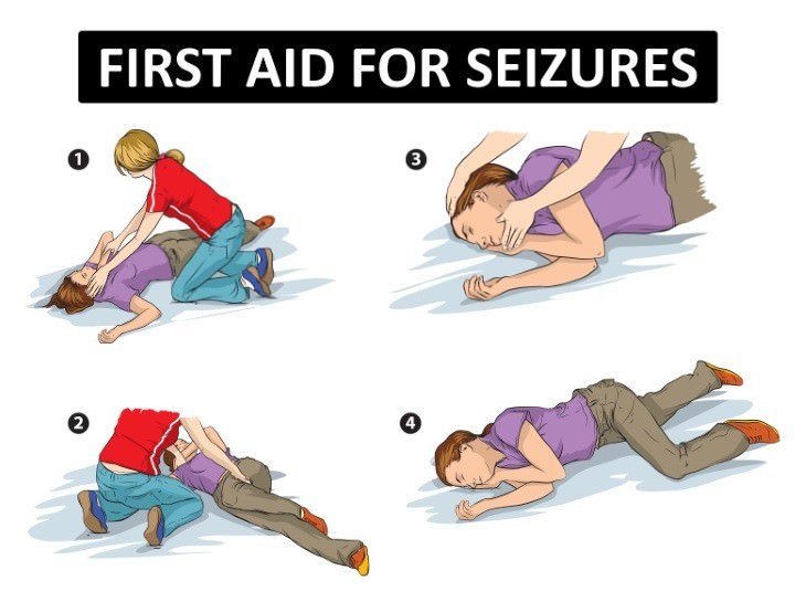 emergency medical aid tips Actions You Can Take if Someone has Seizures