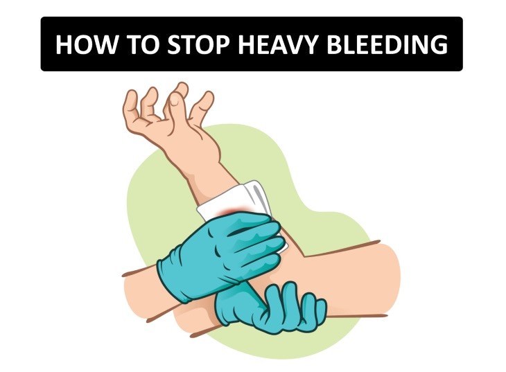 emergency medical aid tips How to stop Bleeding