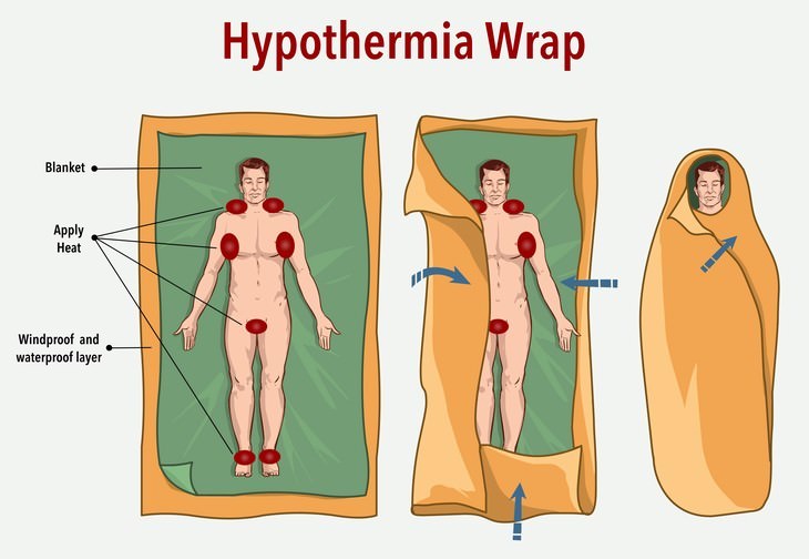 emergency medical aid tips Hypothermia