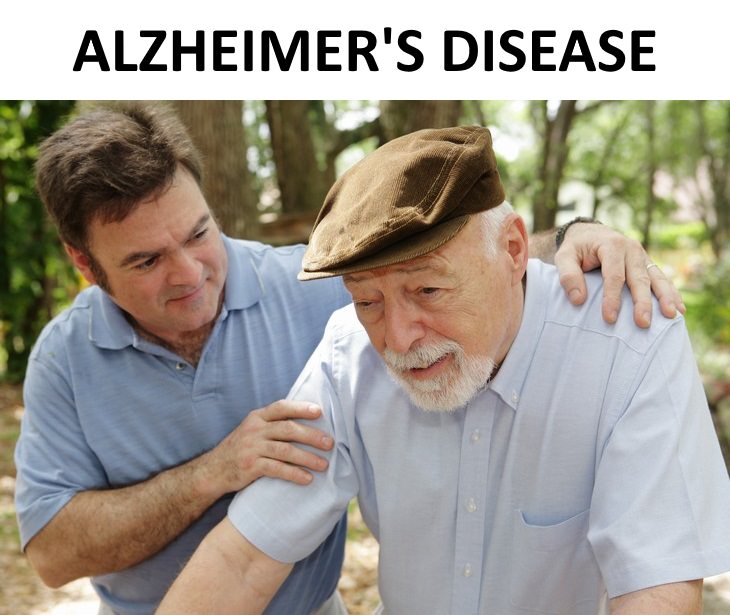 irritability guide Alzheimer’s disease