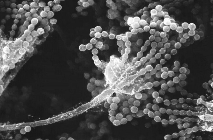 Plastic eating fungus: microscopic mold