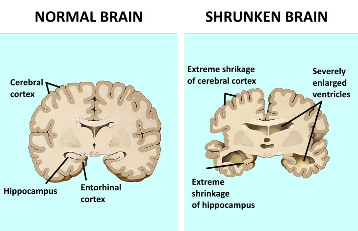 brain body connection stress