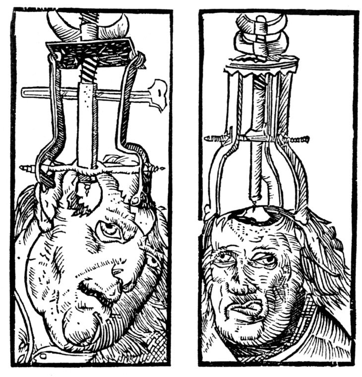 6 Weird and Creepy Medical Tools of the Past Trepanation Devices