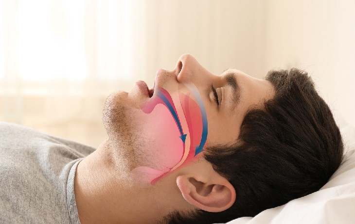 dry mouth health guide man with sleep apnea