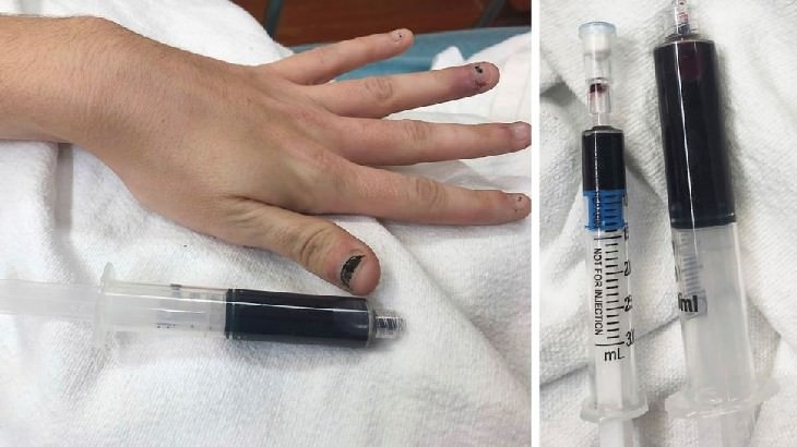 Bizarre Medical Cases of 2019 Blue Blood